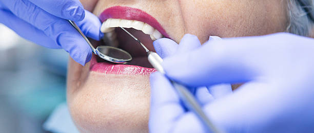 Best Emergency Dental Care for Abscessed Tooth in Pascoag, RI